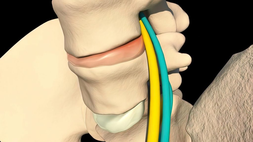 A 3D image of a patient's spine for osteopathy.