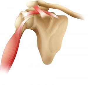 Rotator Cuff