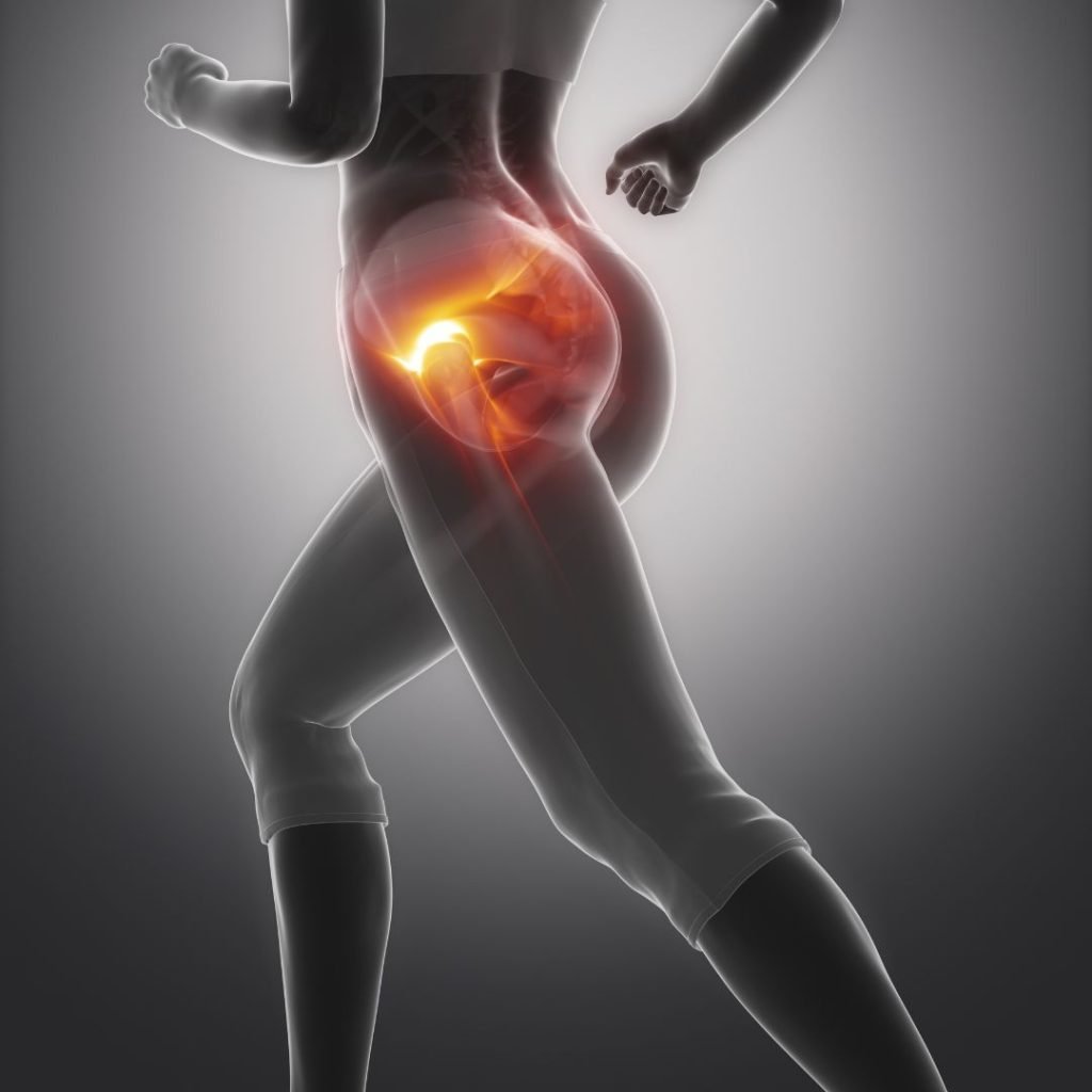 Hip Pain